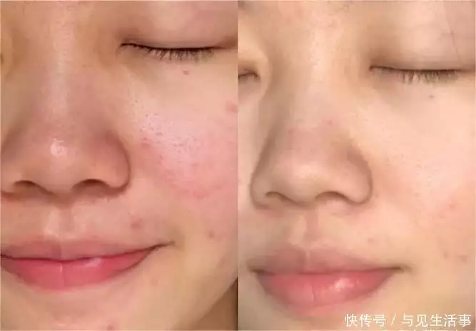 小众敏感肌护肤推荐_小众护肤品_敏感肌小众药妆品牌推荐