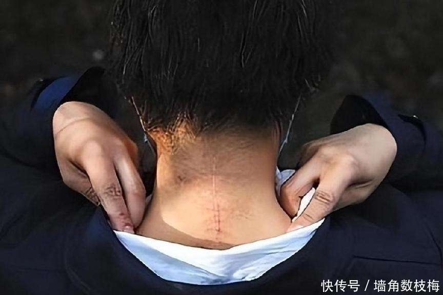 母亲虎口救女被咬身亡，老虎咬人案8年后：女儿仍未被父亲原谅