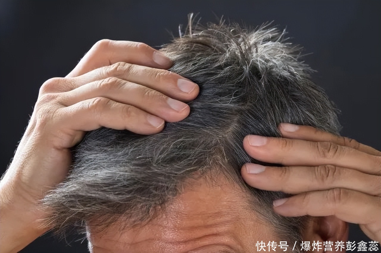哈佛大学的染发致癌调查报告(哈佛大学调查11万人，长达36年的研究，告诉你染发到底致不致癌)