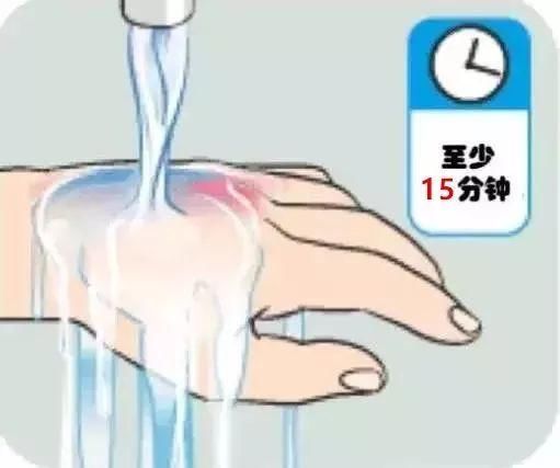  眼球|可怕！仅20分钟眼球被溶化！男孩终生失明！暑假格外要注意！