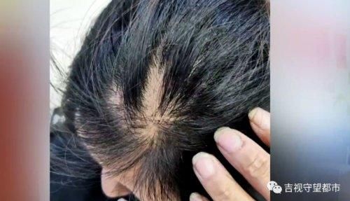 驾驶员|只因劝他戴口罩，男子暴打女司机！