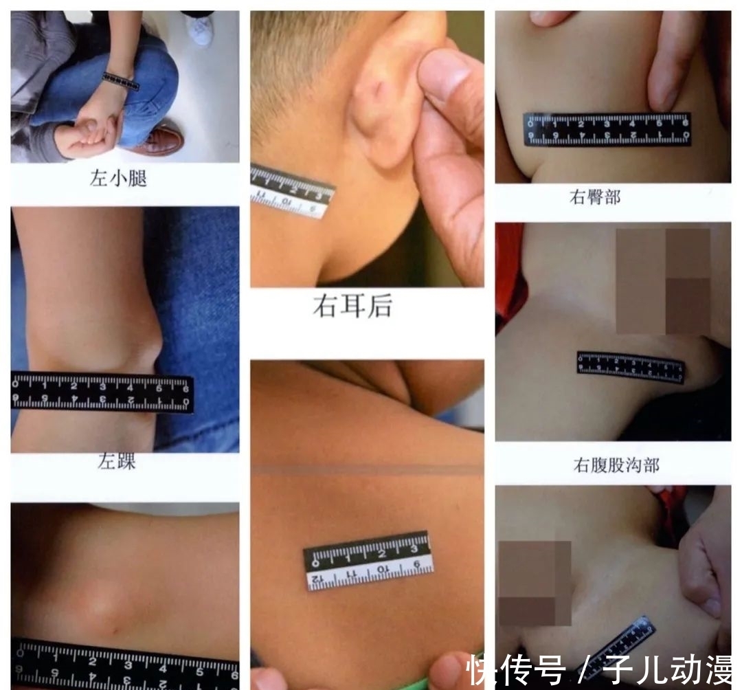 孩子|天津金色摇篮幼儿园针扎虐童案审判:5名幼师均获刑