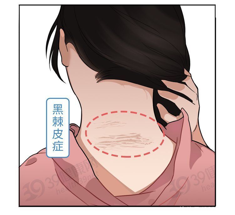 体内有癌哪3个地方变黑(体内有癌，身上会有3处地方发黑，具体是指哪里？早知道早受益)