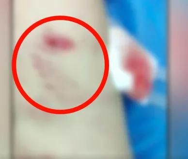  近期|警惕！近期高发，有医院一天接诊119人