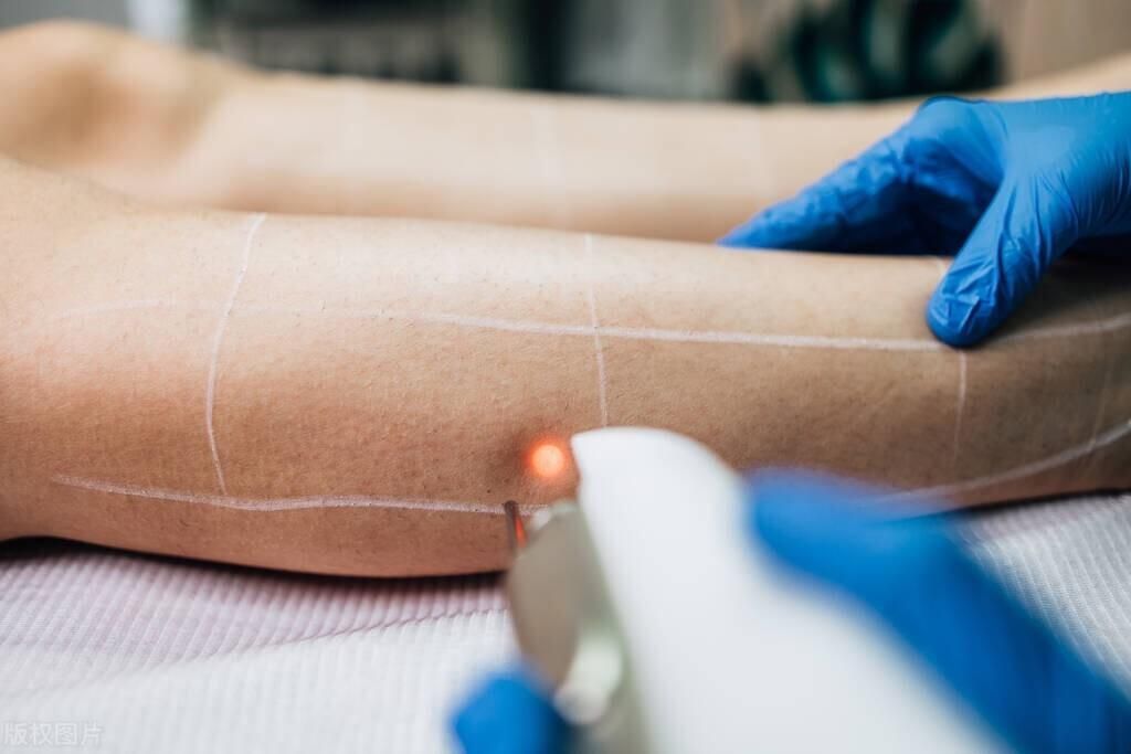 女生腋下毛发旺盛是什么原因(为什么有的女生毛发旺盛，有的却很干净？原因是什么？)