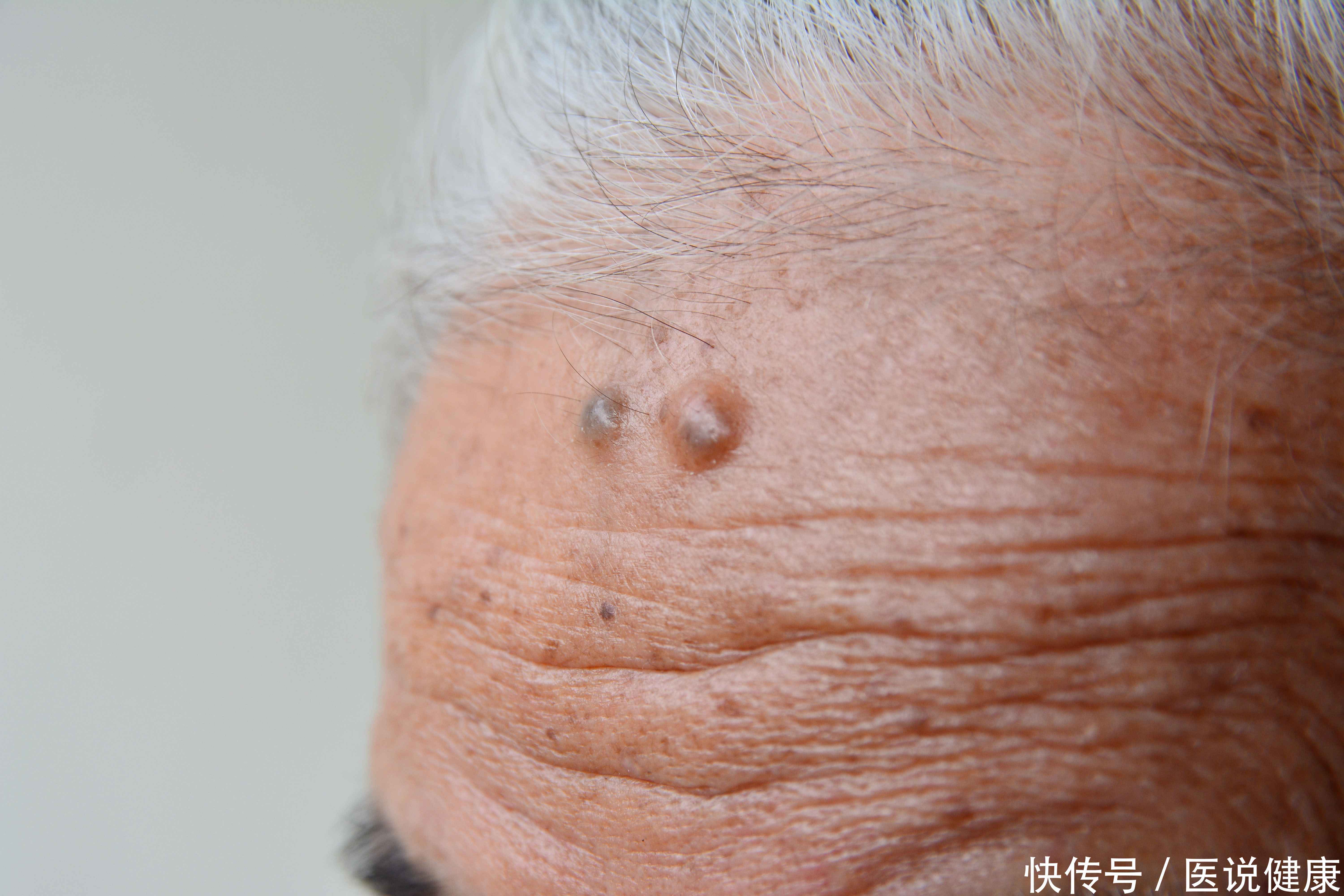 男性开始衰老的4个表现(当男性开始衰老时，身体或有6个特征表现，需留心观察)