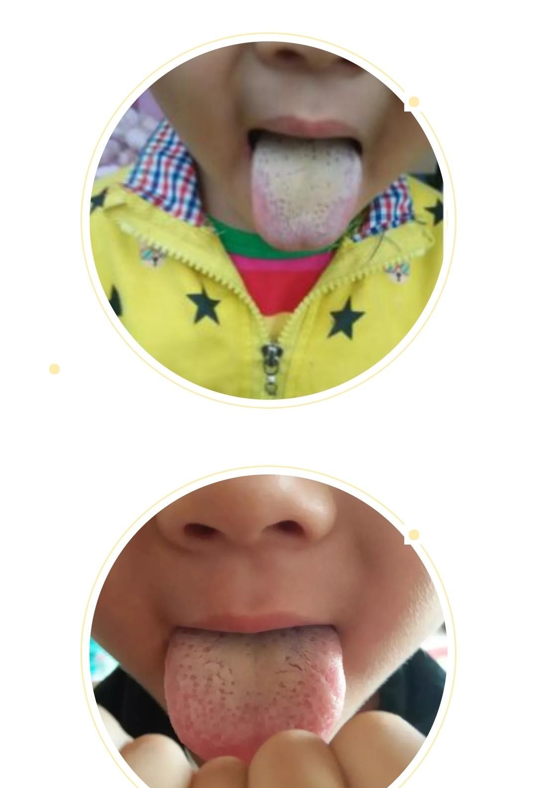  变化|身体健康情况怎么样？可以从舌头进行窥探