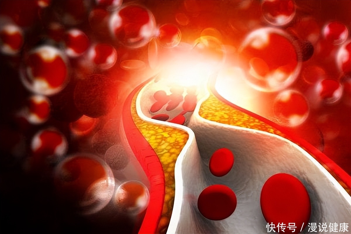 心脏血管堵塞会引起心跳快吗(心跳越快，血管越危险？引起心脏紊乱的4种原因，及时一一排查)