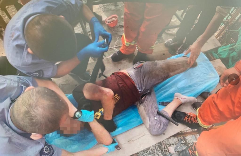  钢筋|太吓人！工人掉入钢筋丛，两米左右的钢筋从腰部穿透到大腿内侧！