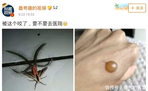 全村老少|网友“水帖”被虫子咬了,底下评论亮眼!要是在古代,唐诗何止三百首