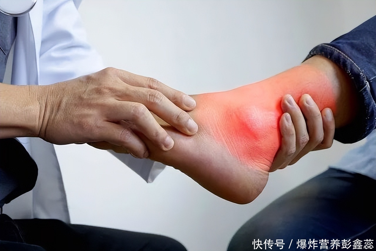 痛风反复发作你需要一个妙招试试(原来这种甜蜜的东西，会让痛风患者反复发作，你经常接触吗？)
