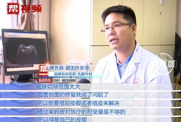 小婷|左乳皮肤潮红，一年内迅速扩散，发现时已是癌症晚期