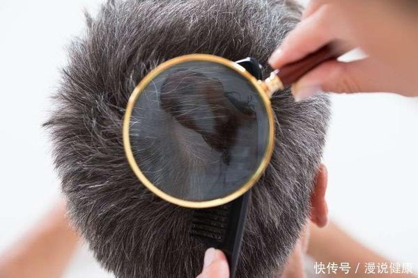 长白发的人不易患癌真的假的(白头发多的人会不容易患癌？关于白发的3个真相，提醒你看一看)