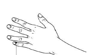  老徐的妻子|42岁男子深夜昏迷，抢救两小时后离世，医生与妻子脱不了干系