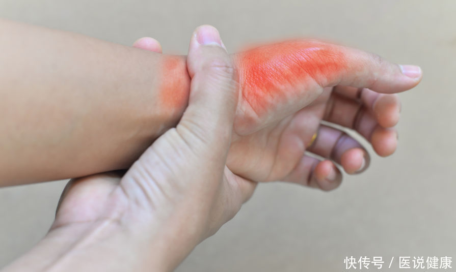 尿酸580大量喝水半年能降下来吗(尿酸高的人，喝水要牢记这4个细节，或能助你排出尿酸)