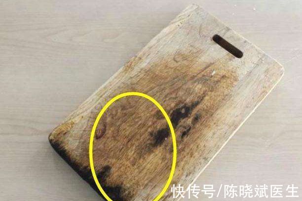 这四种食物是损伤肝脏的罪魁祸首(转告家人:厨房这“3种食物”，或会诱发肝脏病变，建议早些远离)