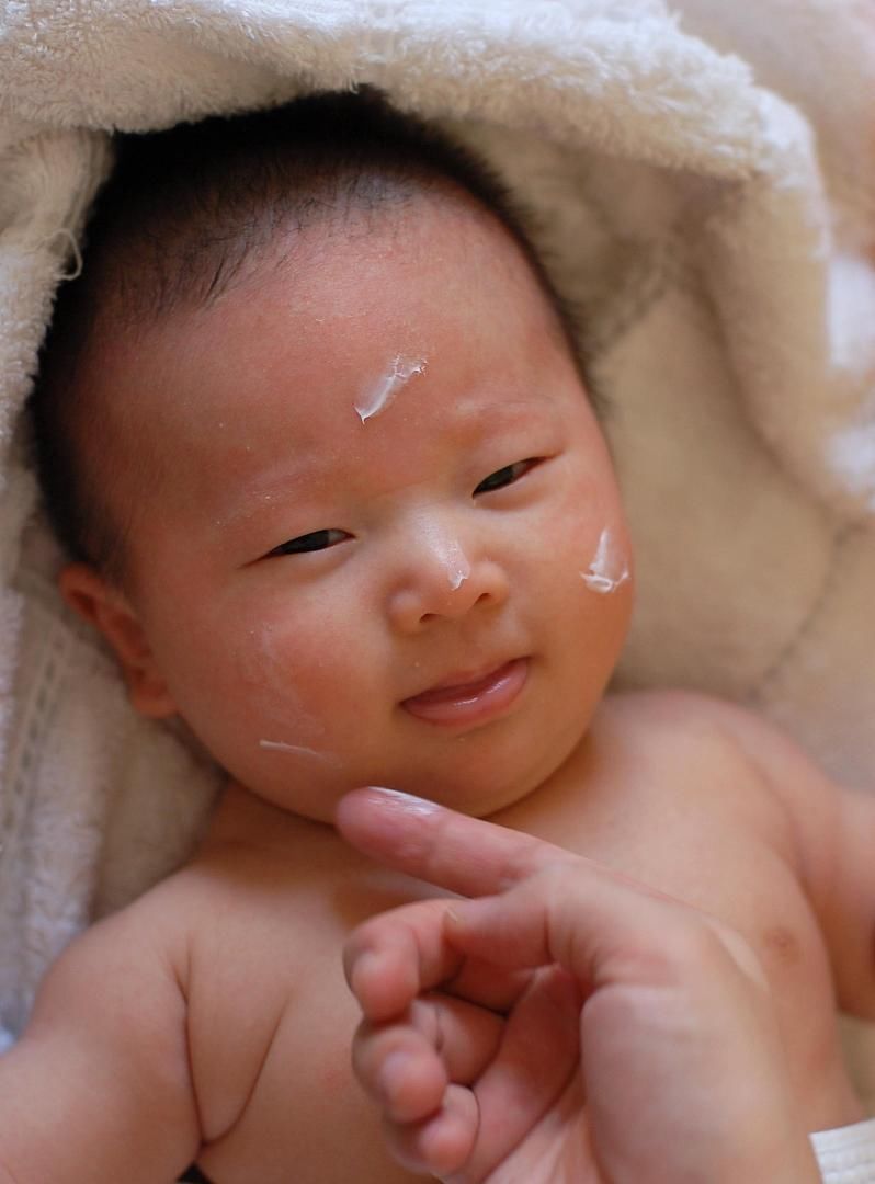  白癜风|立秋之后白癜风患者要注意3件事！饮食“忌口”更不能忽视！