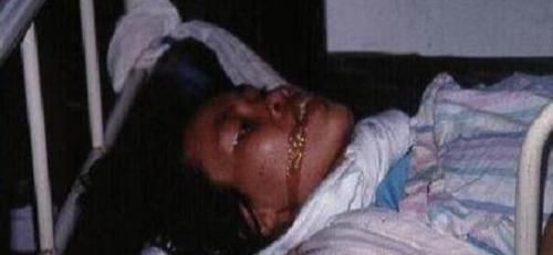 犬病毒|这种疾病是丧尸的原型,一旦发病死亡率近100%,该怎么预防?