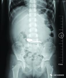  经不起|看好家里的“吞金兽” 他们的小肚子可经不起折腾