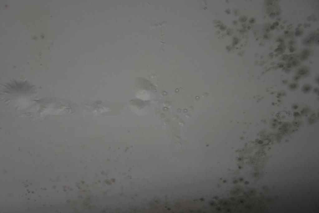  小区|曝光！涡阳这小区的房子不敢住了！推卸责任！业主苦不堪言...