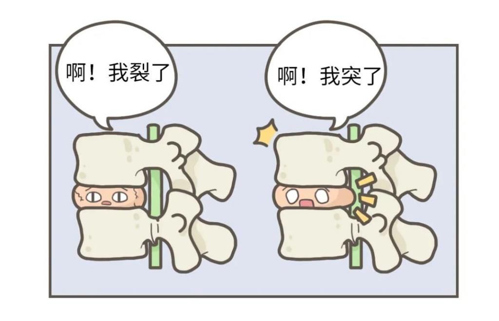 韧带和肌肉|一个伤腰的姿势，你可能每天都在做
