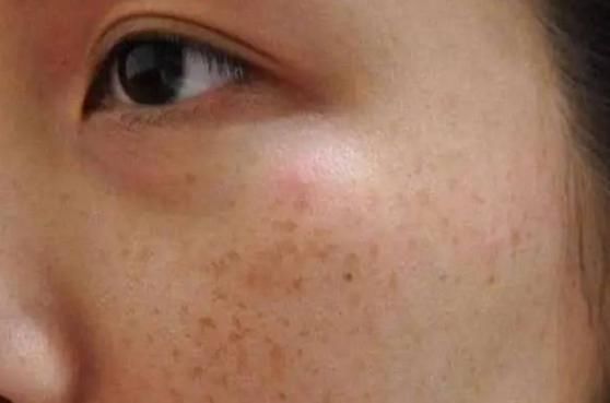 开心|小小桑叶,大有用途,坚持泡水喝,4大好处会让你“开心不已”