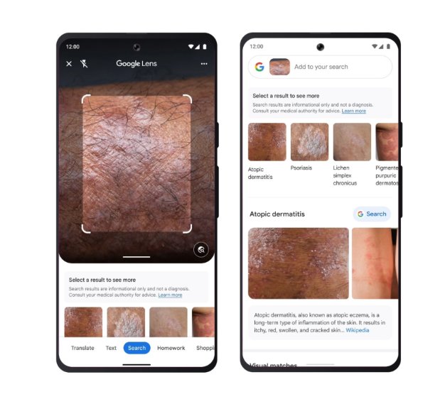 谷歌推出多项功能：识别皮肤病、模拟试穿衣服