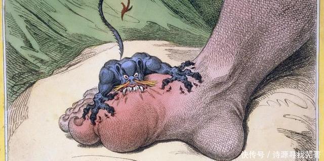  常见|我们的祖先如何对抗痛风有3种神奇植物，还有1种常见野草！