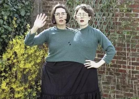  连体|假如连体人中其中一个去世，另一个会怎么样？知道真相让人心疼猫腻