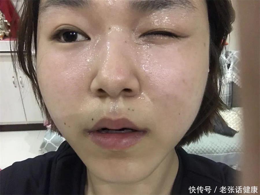 天气热眼睛干涩是怎么回事(天热出汗太多，眼睛总是干涩难受？这些护眼方法亲测有效)