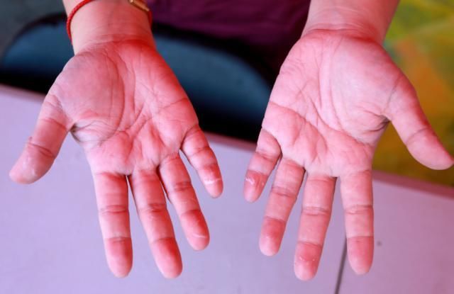  大白|谢谢你，大连“大白”！让我们一起守护大连