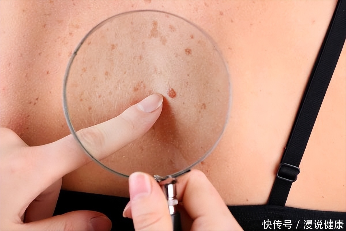 记住了癌细胞最怕你做这9件事(为何癌细胞总喜欢“死灰复燃”？或许因这4点，提醒患者做好5件事)