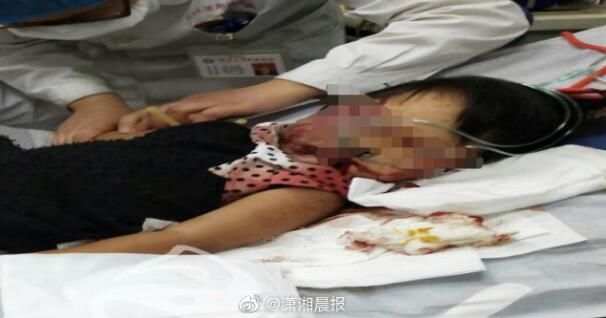  男子|男子持铁锹当街暴打老人小孩！老人当场死亡 孩子重伤