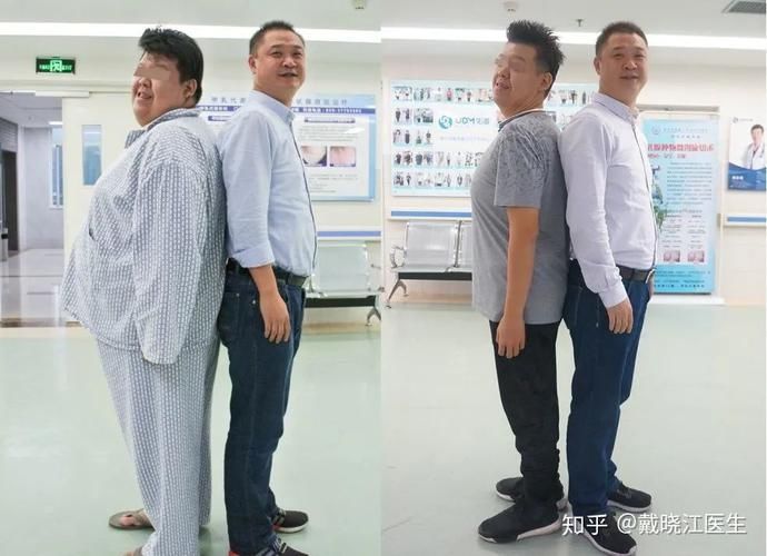  糖尿病|杨天真为什么要做切胃术？