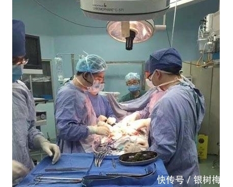 94岁老太肚子巨胀,医生开刀看清后,吓得医生发呆了整整9秒钟-第3张图片-大千世界 94岁老太肚子巨胀,医生开刀看清后,吓得医生发呆了整整9秒钟-第3张图片-大千世界