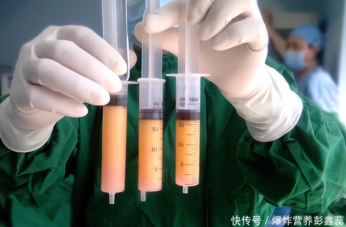 为什么有人喜欢吃油大的(为什么人喜欢吃油大的食物？不是因为你有多馋，而是身体本能？)