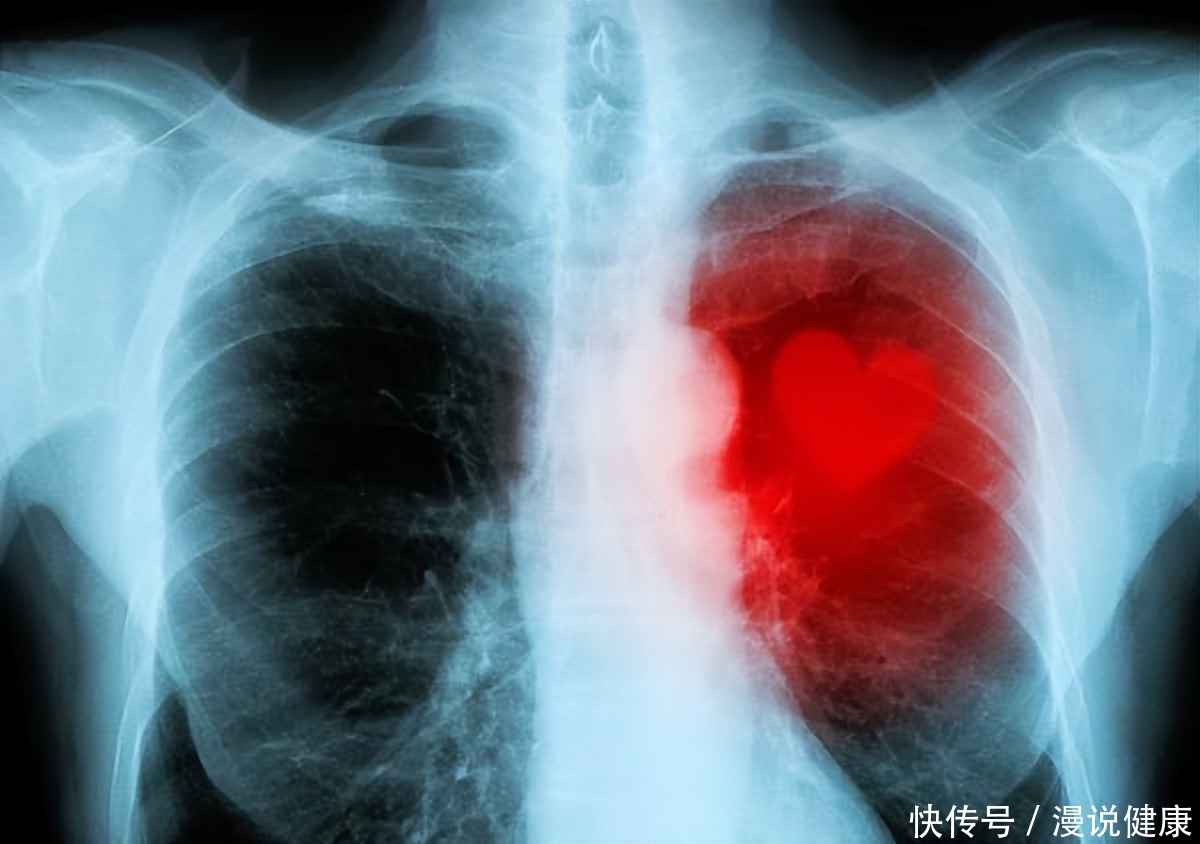 癌症治愈五年后复发的可能性(即便癌症治愈，也存在复发几率！做好这5件事，减少癌症复发几率)
