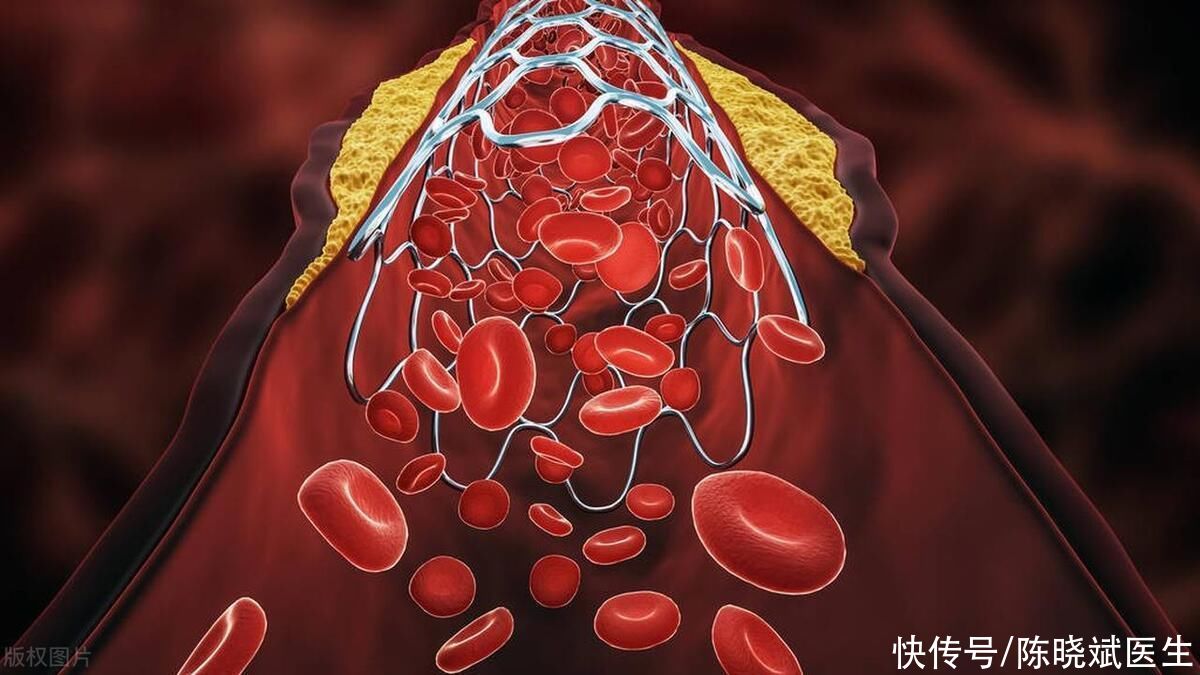 血管开始变硬会露出这4个马脚(血管开始变硬，身体会露出这4个“马脚”，建议你自查看看)