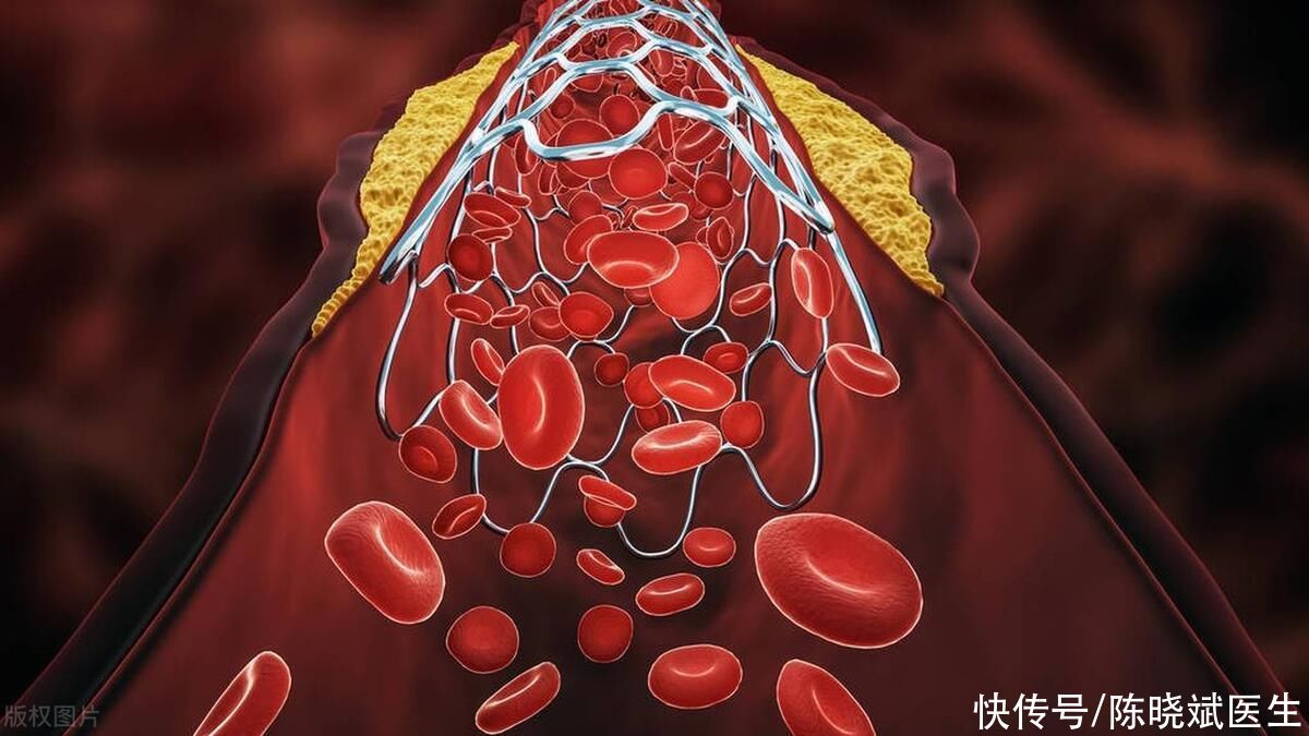 血管开始变硬，身体会露出这4个“马脚”，建议你自查看看