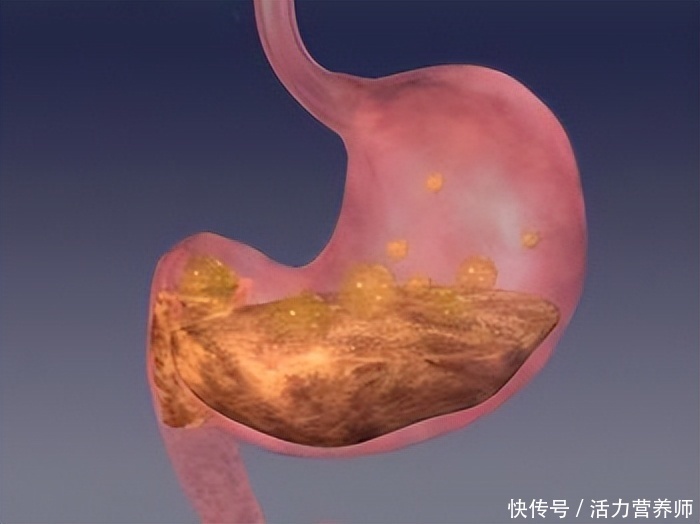 多长时间能消化完胃里的食物(我们吃进去的食物，胃多久才能消化掉？想要养胃，少吃这类食物)