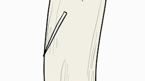 异物|杭州一女子胃内惊现14cm大勺子!原因竟是……