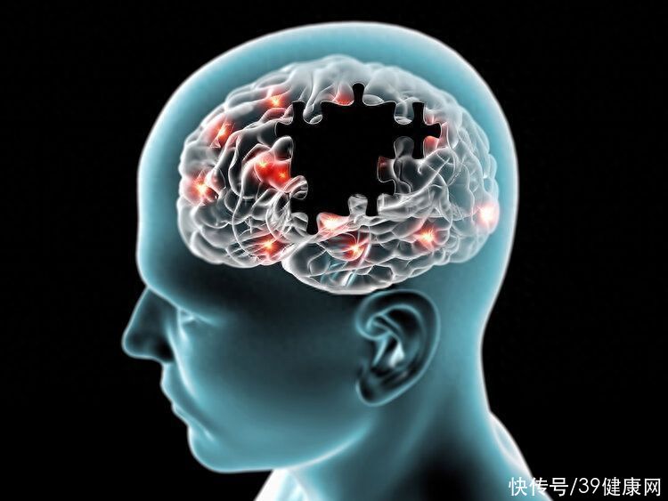 老了怕痴呆？再三提醒：不想大脑“老”太快，4个吃饭习惯尽早改2023