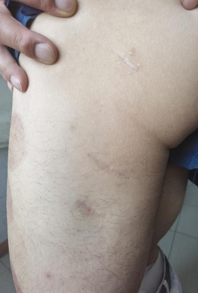  张杰|他24年前救下被调戏女孩遭歹徒连砍4刀，女孩人间蒸发，如今…