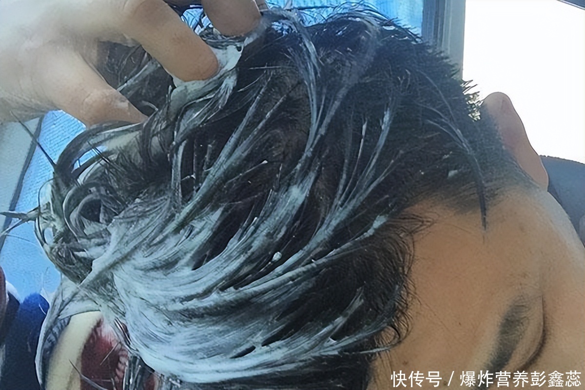洗完头发，“自然风干”还是“吹风机吹”？哪种方式对头发最有益