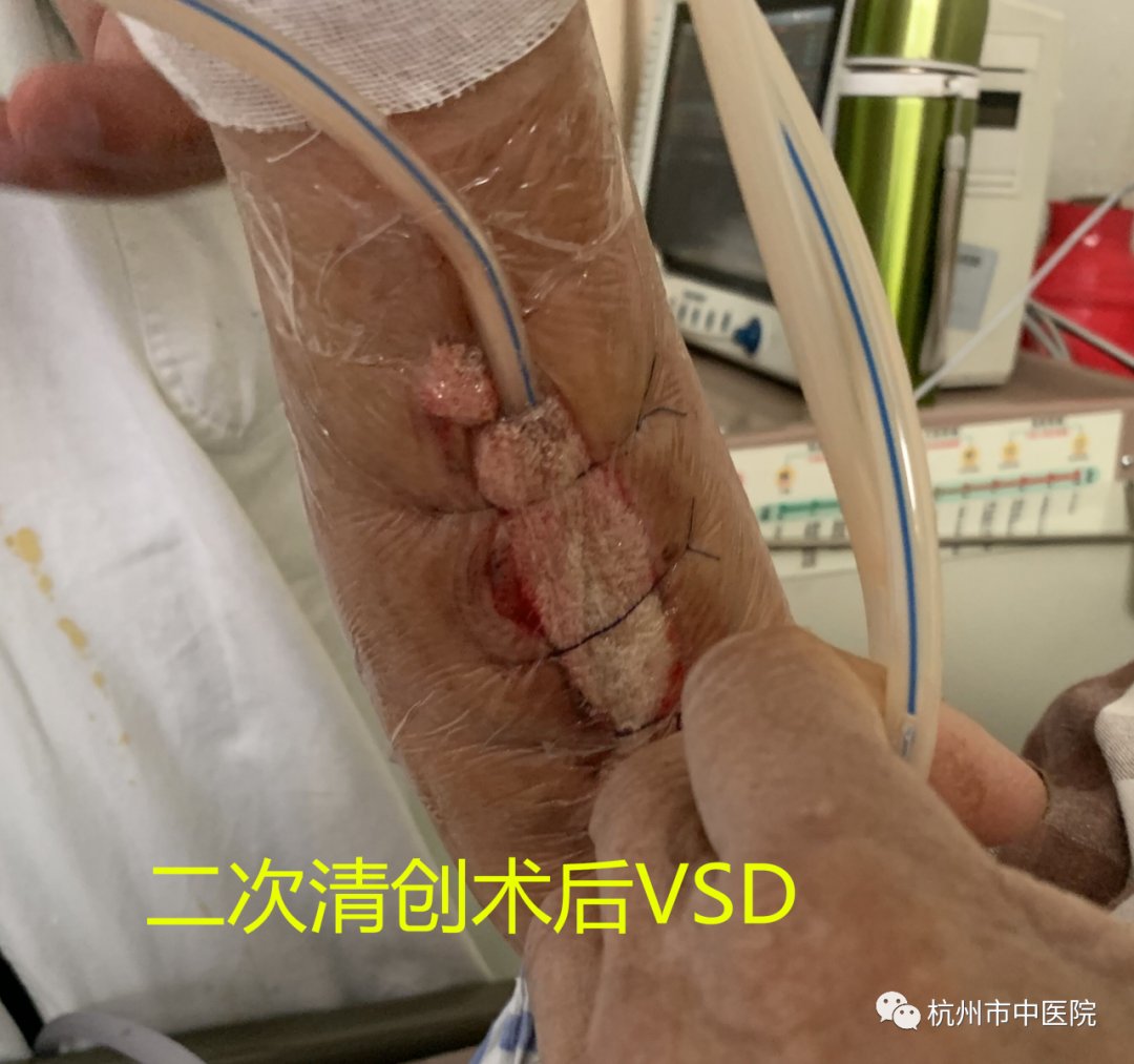 男子|男子烧了条黄鱼，结果被下“病危通知书”