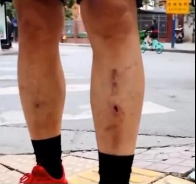 对不起|对不起，这一亿被他们辱骂的人，正在被迫消失！