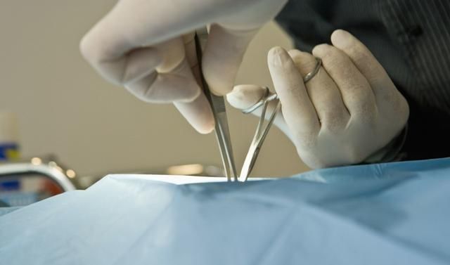  医方|医疗纠纷：羊水栓塞被认定为一级甲等医疗事故，医方赔偿60余万元