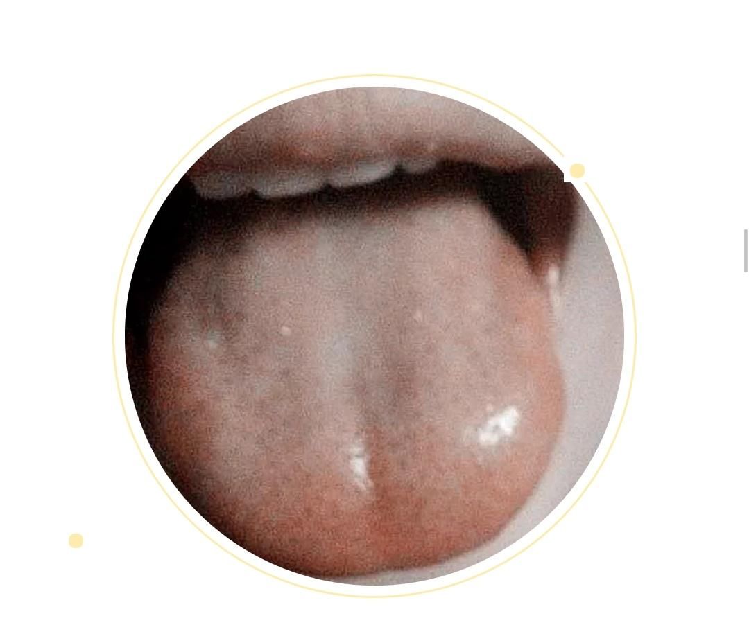  变化|身体健康情况怎么样？可以从舌头进行窥探