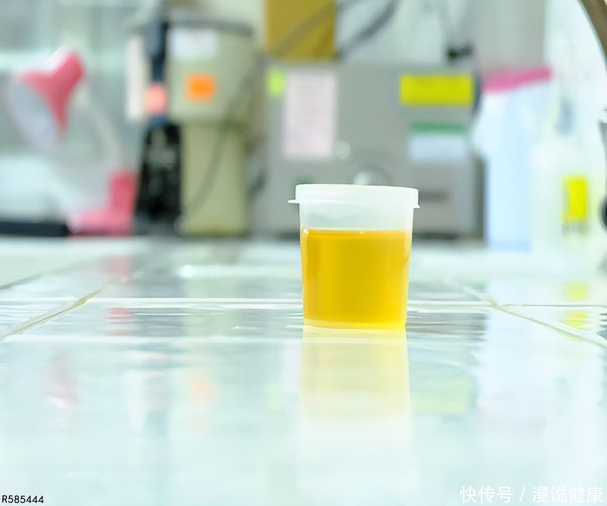 机体检测出HPV阳性，有必要治疗吗？这5个知识，女性需事先了解下2023