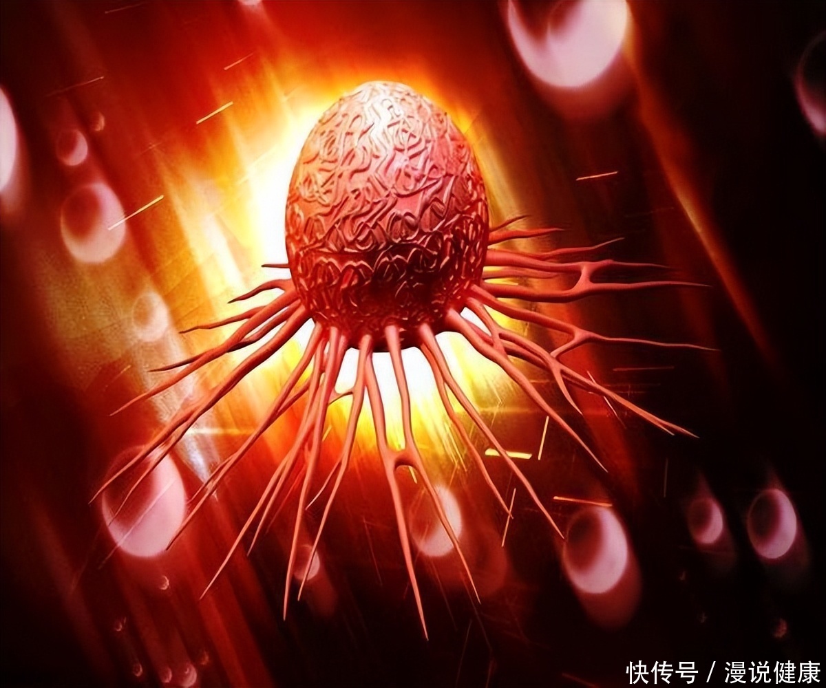 每年有800万人死于癌症？为何癌细胞会转移，或存在这2点原因2023
